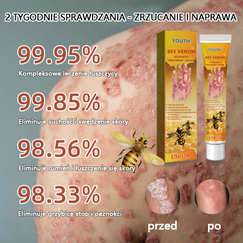 🐝Youth® Bees Venom Psoriasis Treatment Cream-2023 (odpowiedni dla wszystkich chorób skóry)