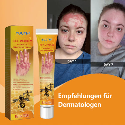 🐝Youth® Bees Venom Psoriasis Treatment Cream-2023 (odpowiedni dla wszystkich chorób skóry)